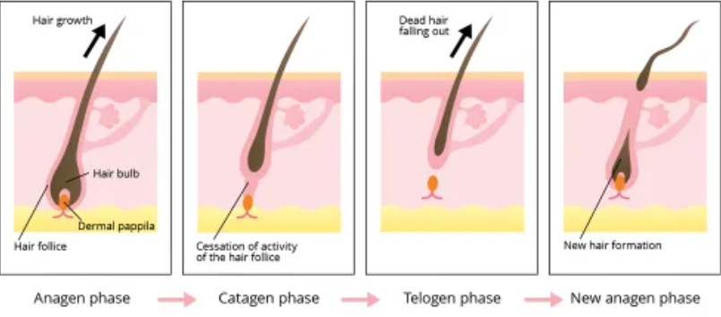 nguyên nhân rụng tóc do DHT